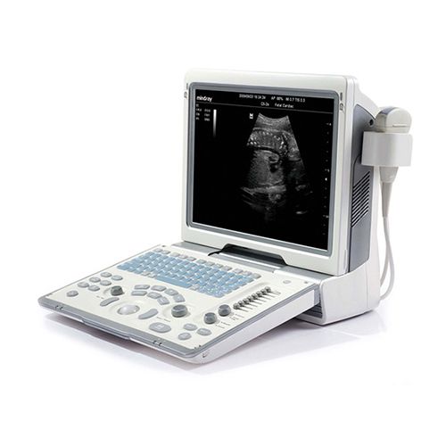 MINDRAY-DP-50-portable-ultrasound-machine-for-sale-1