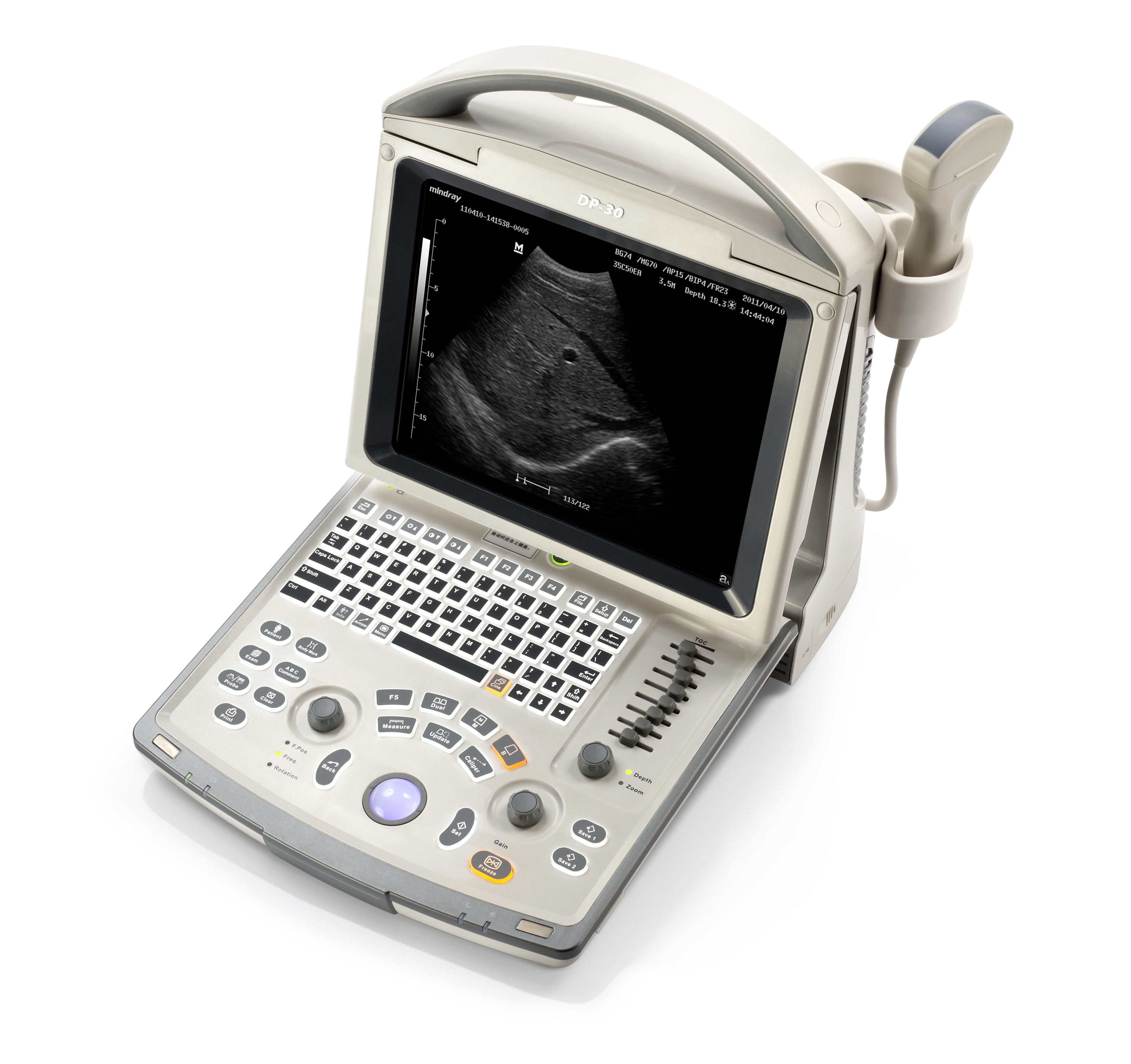 ultrasound device