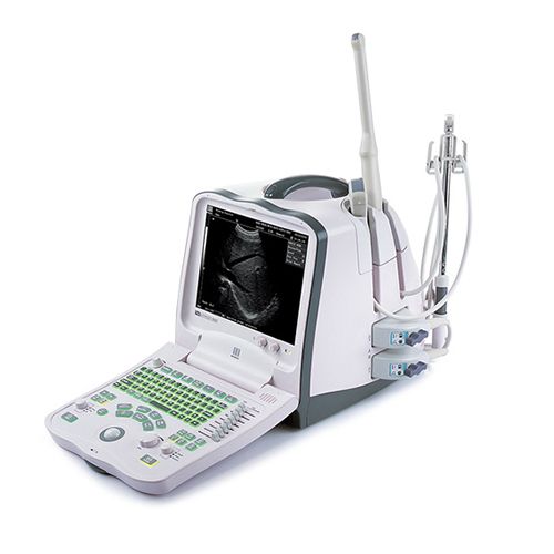 portable ultrasound machine for sale south africa