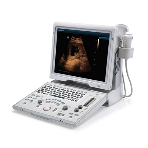 MINDRAY-Z6-portable-ultrasound-machine-for-sale